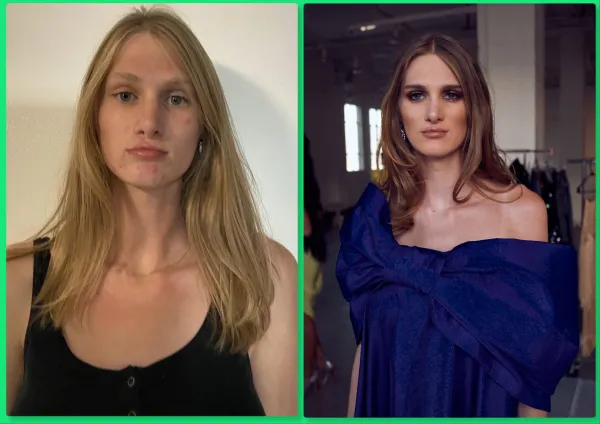 Photos of model